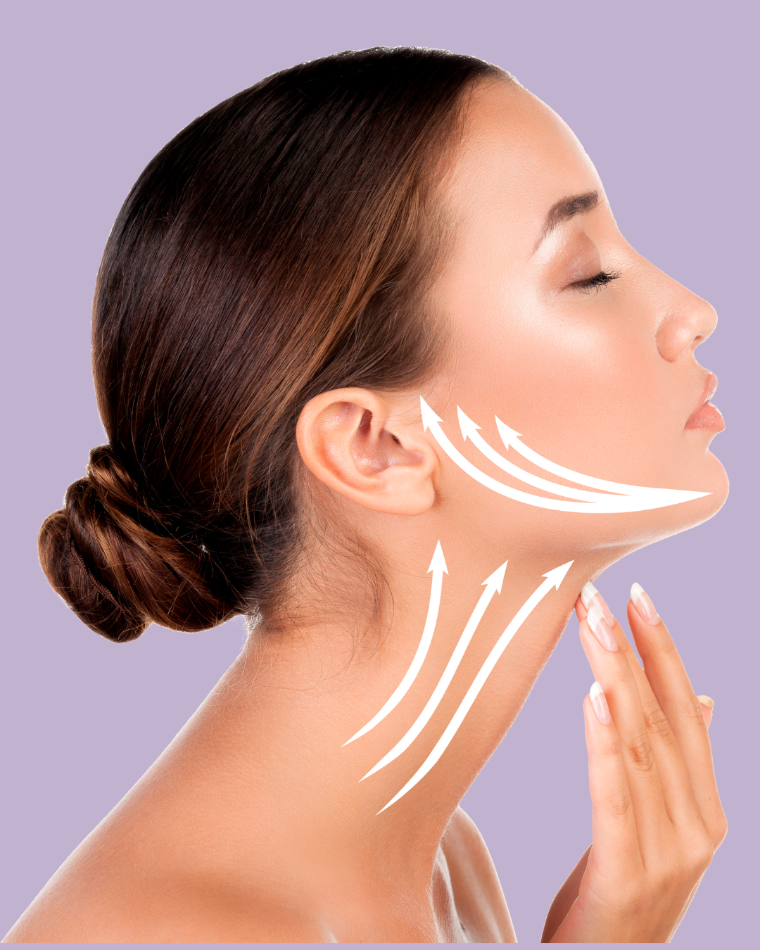 PDO thread lift treatment