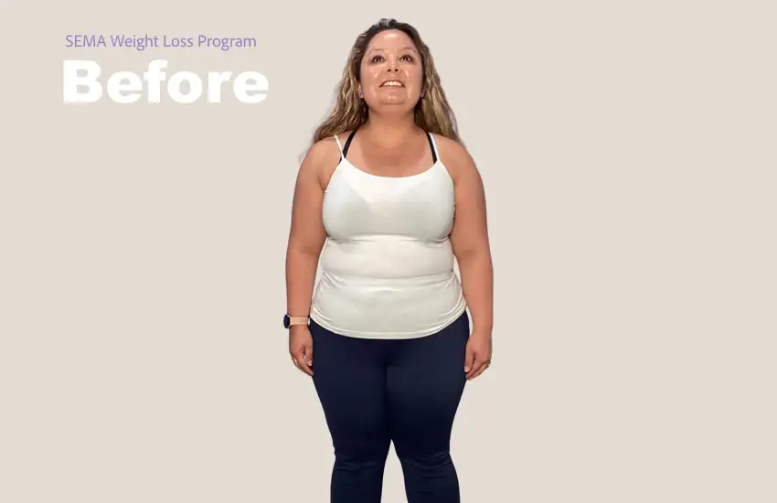 Patient before starting GLP-1 semaglutide weight loss program at Prime Vitality Care San Antonio