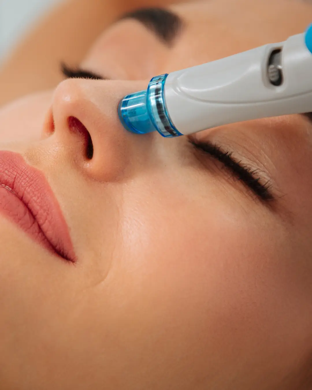 HydraFacial treatment