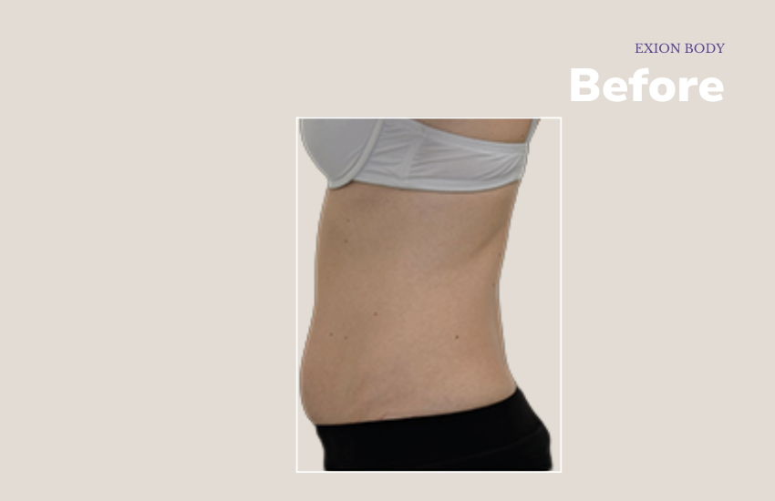 Before abdomen