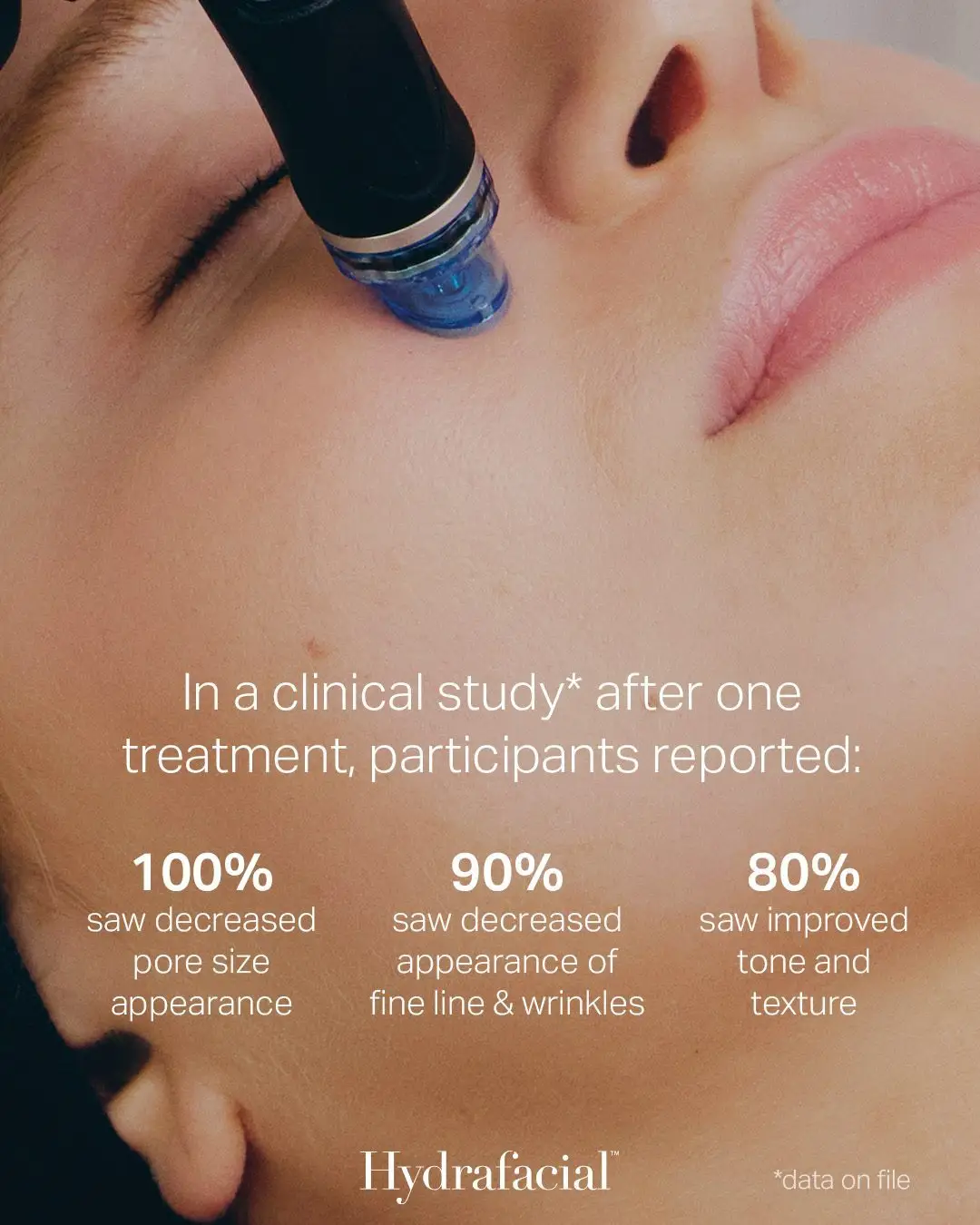 Deluxe HydraFacial