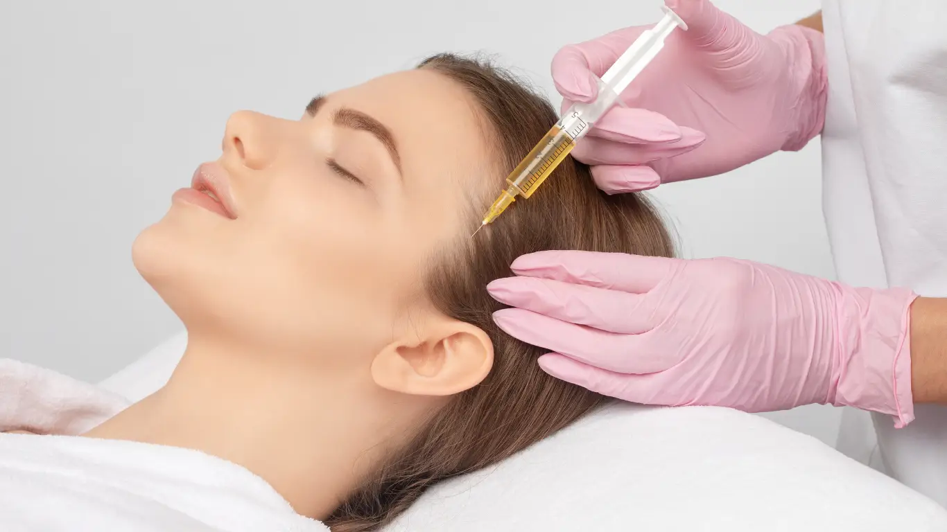 PRP hair therapy syringe prepared for scalp injections