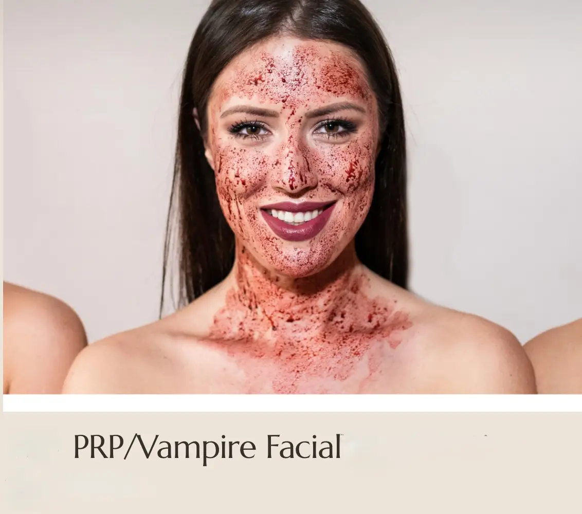 Microneedling