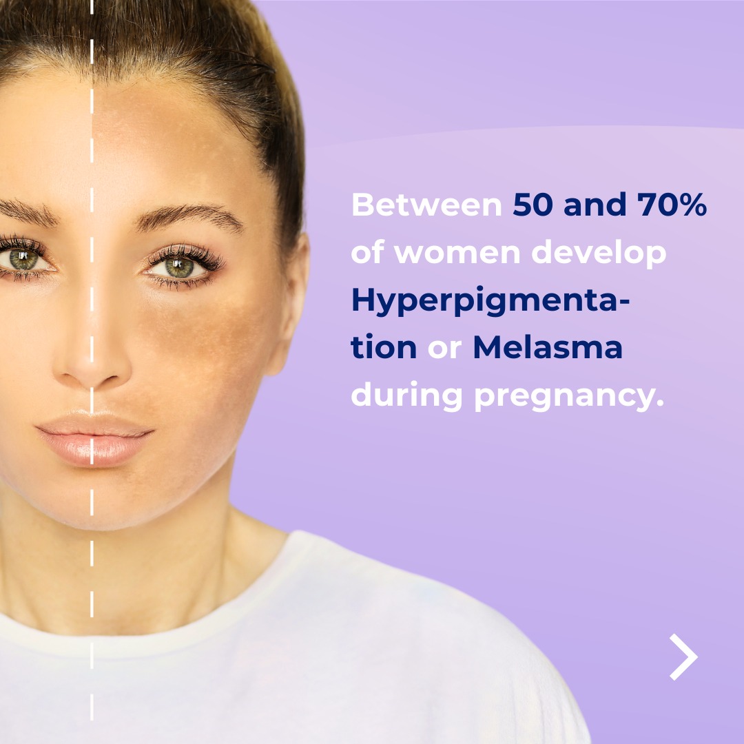 Dermafuse Facial