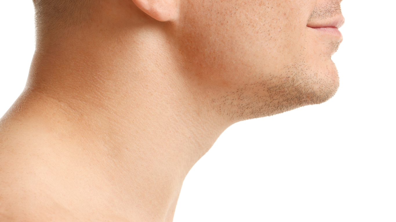 NeckTite skin tightening treatment