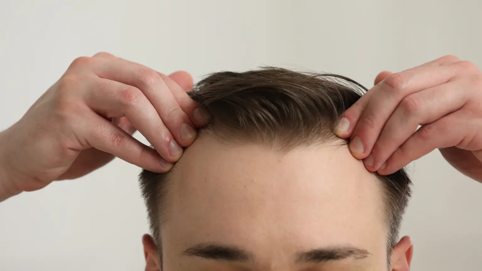 Man with early hair loss considering PRP therapy