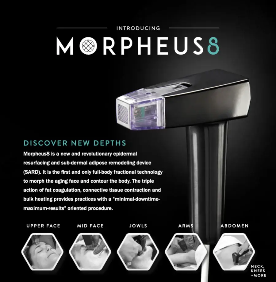 Morpheus8 RF microneedling